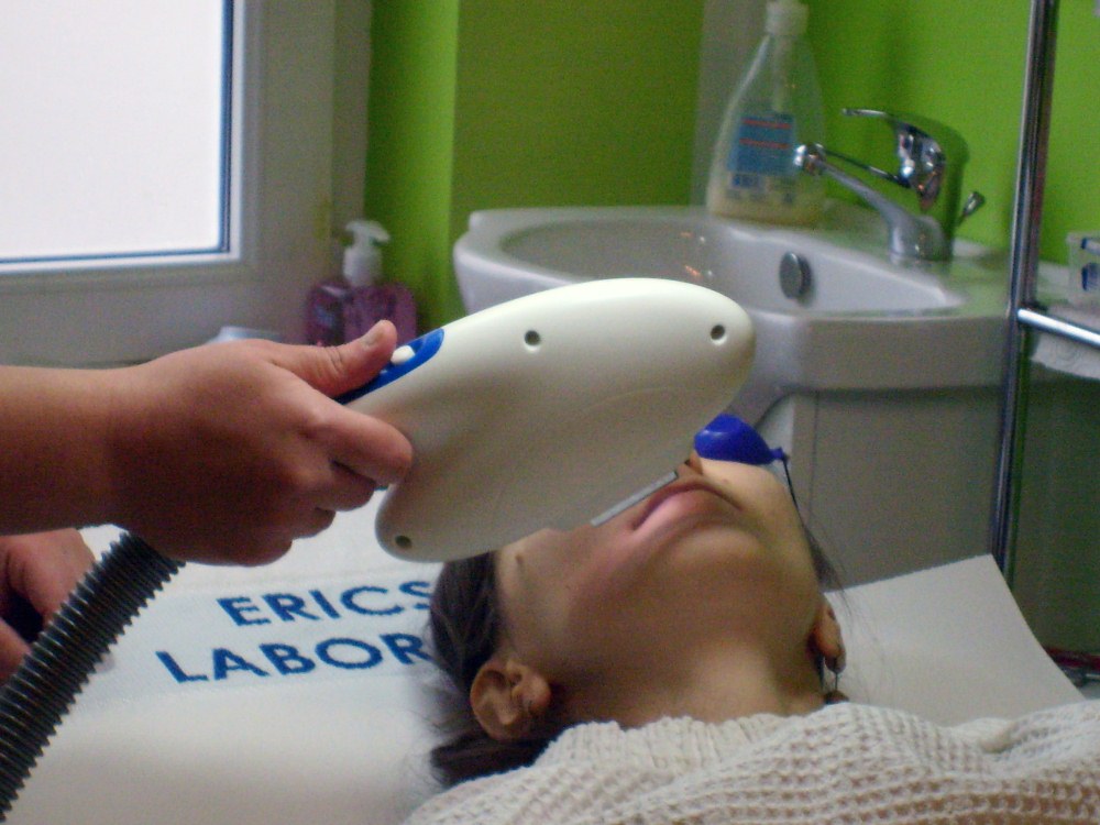 foto tratament cu laser 2